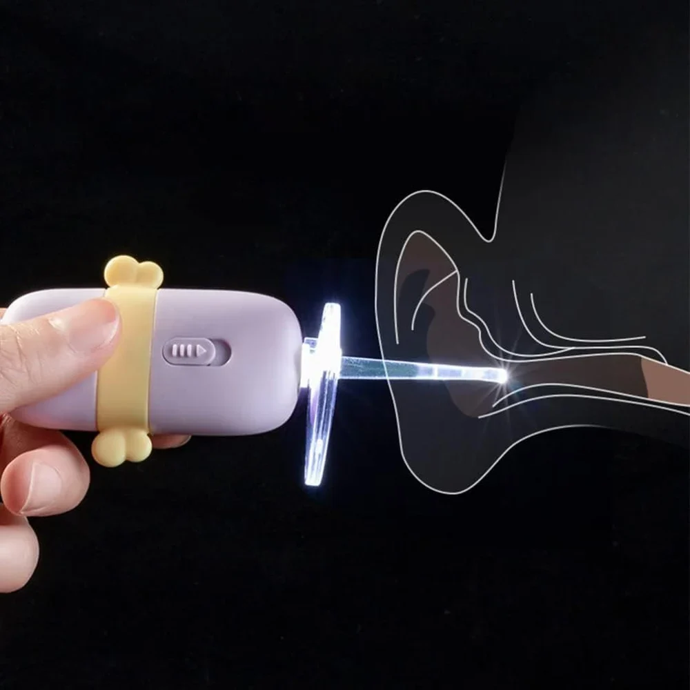 Smart Visual Earwax Remover with HD Camera